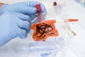 Custom Plastic Bags with a Logo: Elevate Your Packaging Game with AI 650 Specimen Bags