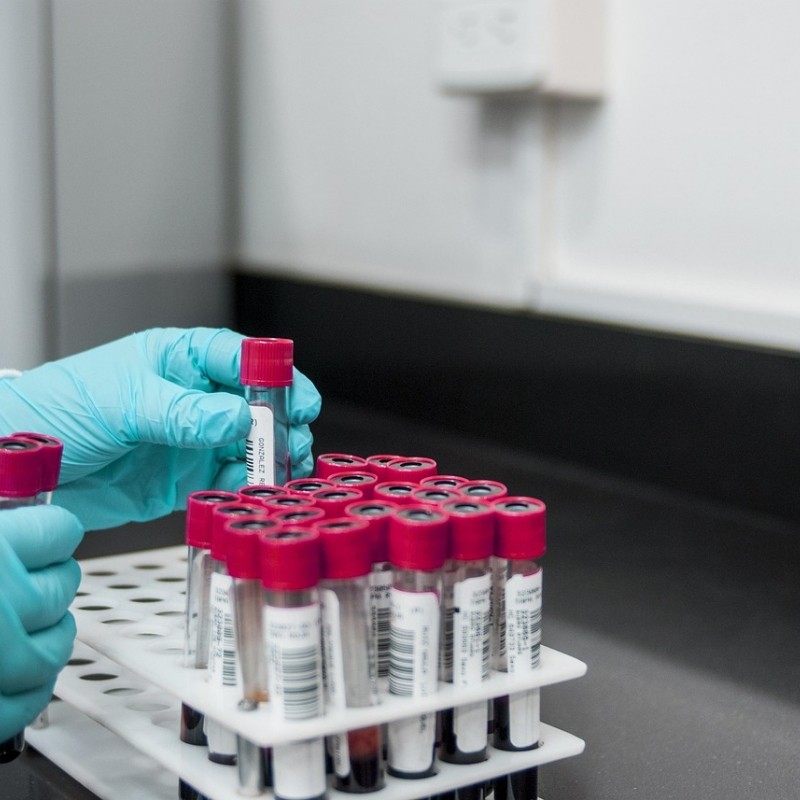 What Makes a Good Lab Supply Manufacturer in China?