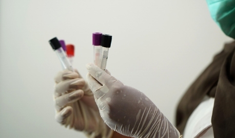 Packaging and transportation of biological sample banks