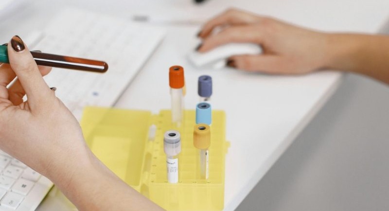 blood sample hemolysis